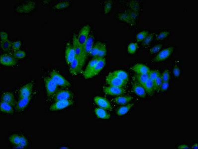 ITGAL Antibody