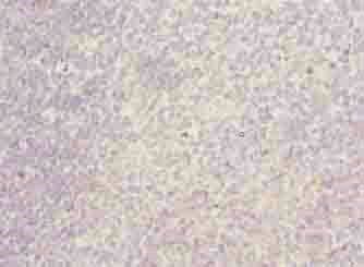 ITGAL Antibody