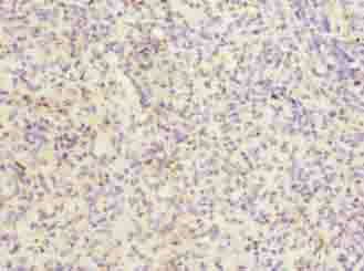 ITGAL Antibody