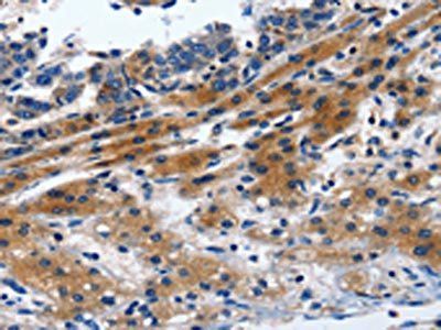 ITGAL Antibody