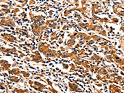 ITGAM Antibody