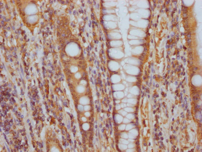 ITGAV Recombinant Monoclonal Antibody