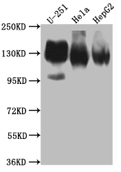 ITGAV Recombinant Monoclonal Antibody