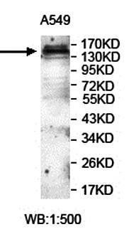 ITGB1 Rabbit Polyclonal Antibody