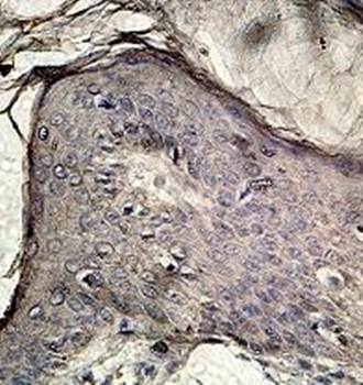 ITGB1 Rabbit Polyclonal Antibody