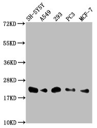 ITGB1BP1 Antibody