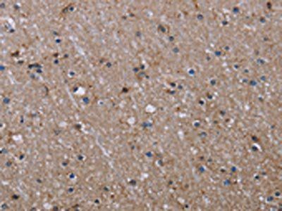 ITGB2 Antibody