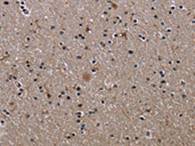 ITGB2 Antibody
