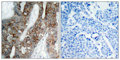 ITGB3 Antibody