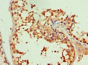 ITGB3 Antibody