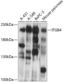 ITGB4 antibody