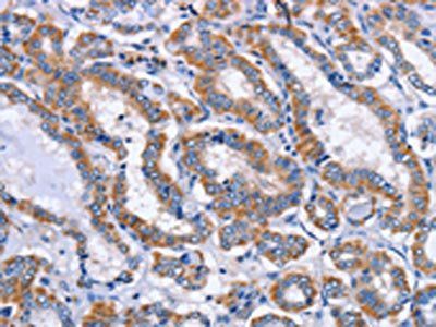 ITGB5 Antibody