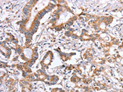 ITGB5 Antibody