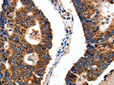 ITGB6 antibody