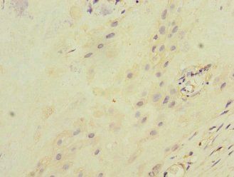 ITGB8 Antibody