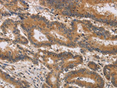 ITIH1 Antibody