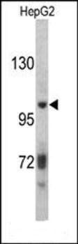 ITIH2 antibody