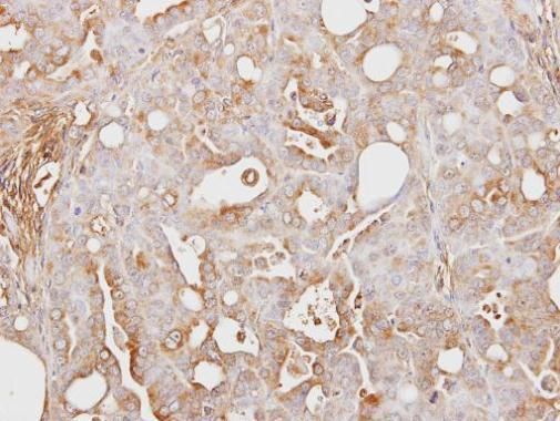 ITIH3 antibody [N1N3]