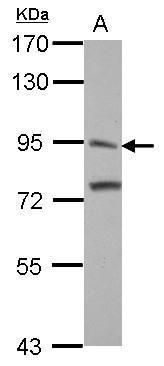 ITIH3 antibody