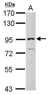 ITIH3 antibody