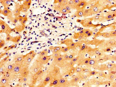 ITIH4 Antibody