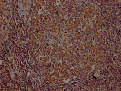 ITK Recombinant Monoclonal Antibody