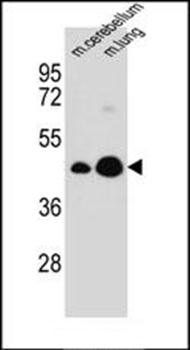 ITM2B antibody