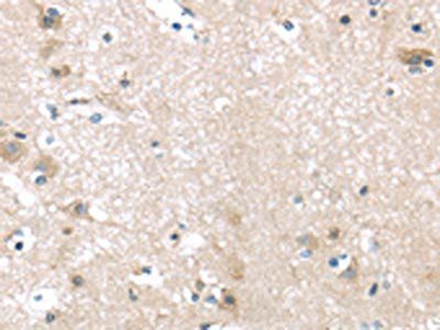 ITPA Antibody