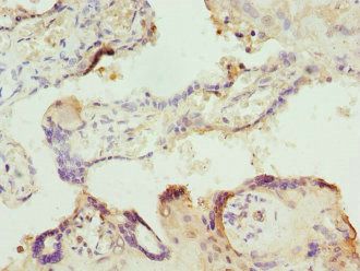 ITPK1 Antibody