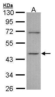 ITPK1 antibody [N3C3]