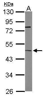 ITPK1 antibody [N3C3]