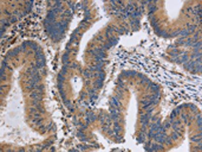 ITPR1 Antibody