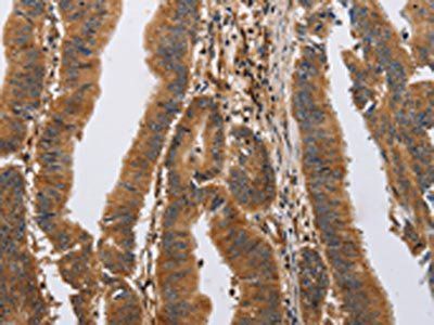 ITPR1 Antibody