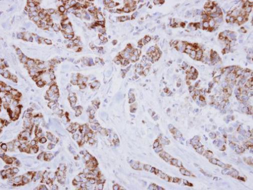 IVD antibody
