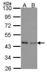 isovaleryl-CoA dehydrogenase Antibody