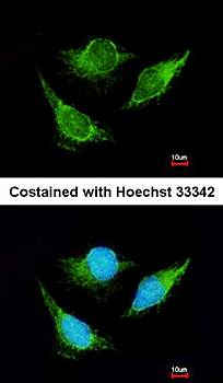 IVD antibody