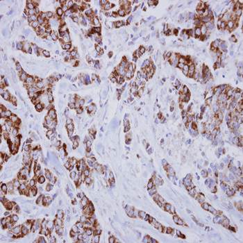 IVD antibody