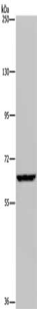 IVL Antibody