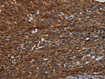 IVL Antibody