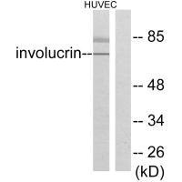 IVL antibody