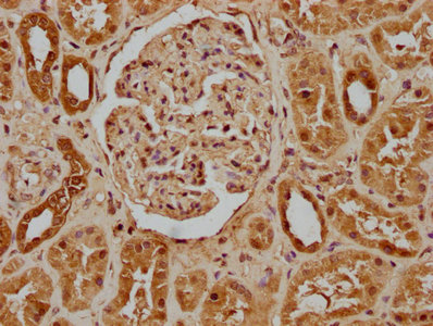 IVNS1ABP antibody