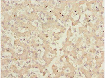 IWS1 Antibody