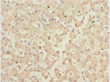 IWS1 antibody