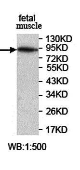 IWS1 Rabbit Polyclonal Antibody