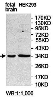 IYD antibody