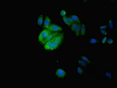 Izumo sperm-egg fusion protein 4 antibody