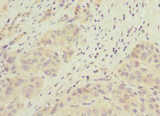JADE1 Antibody