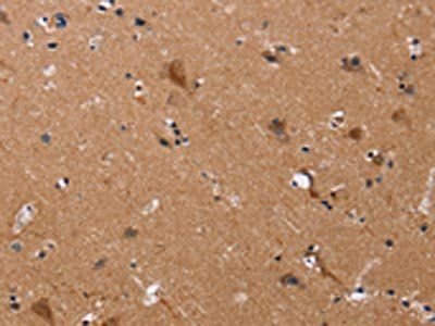 JAG1 Antibody
