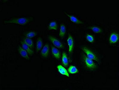 JAGN1 Antibody