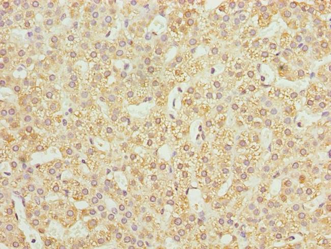 JAGN1 Antibody